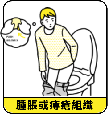 腫脹或腫塊